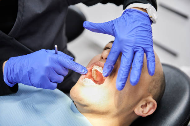 Best Emergency Dental Care for Broken or Chipped Teeth in Temelec, CA